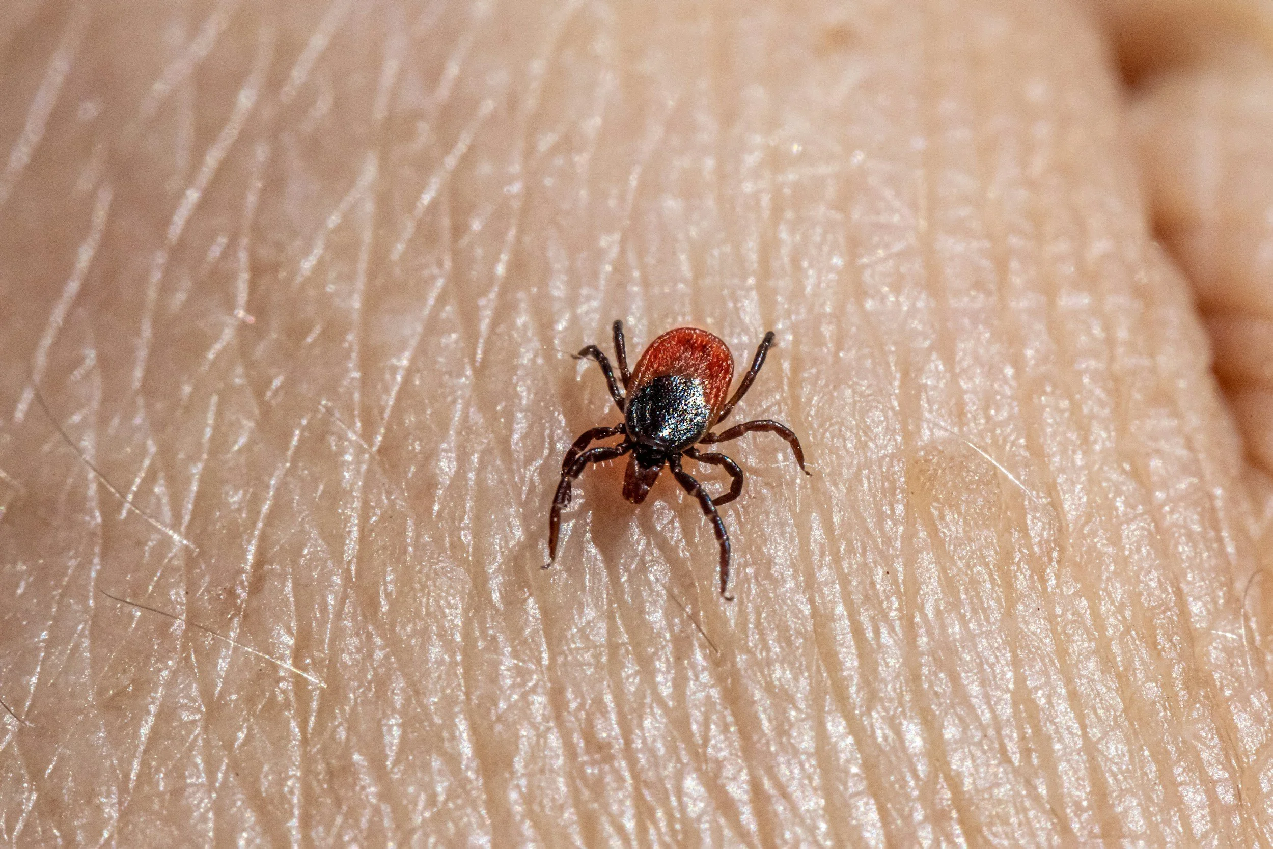 TICKS SAFETY 