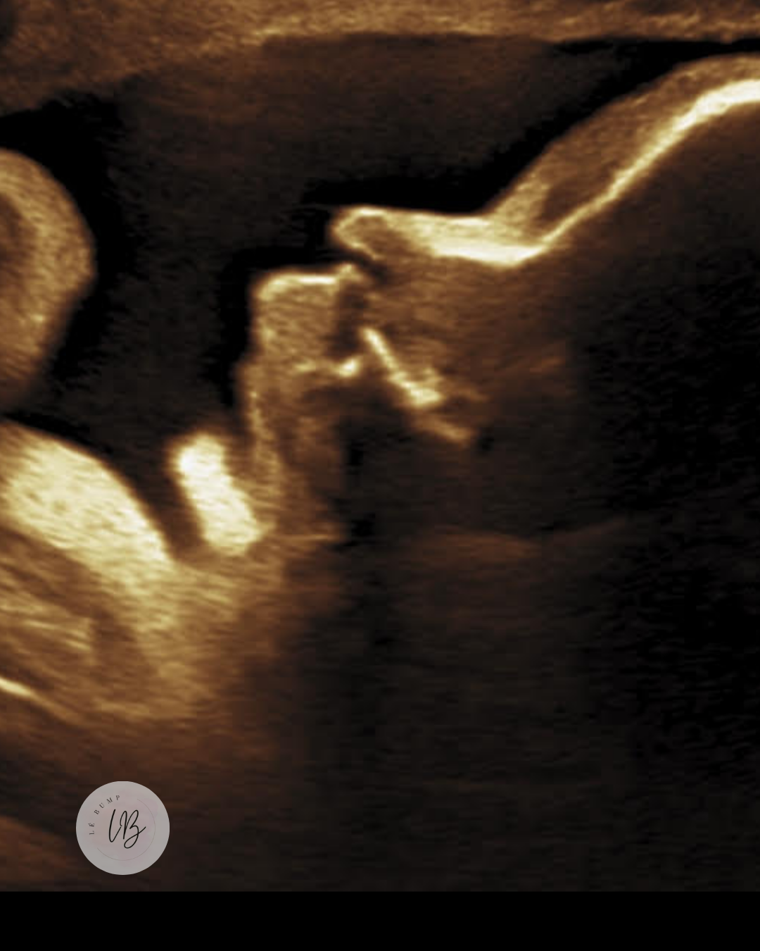 “It’s a baby boy ! ”