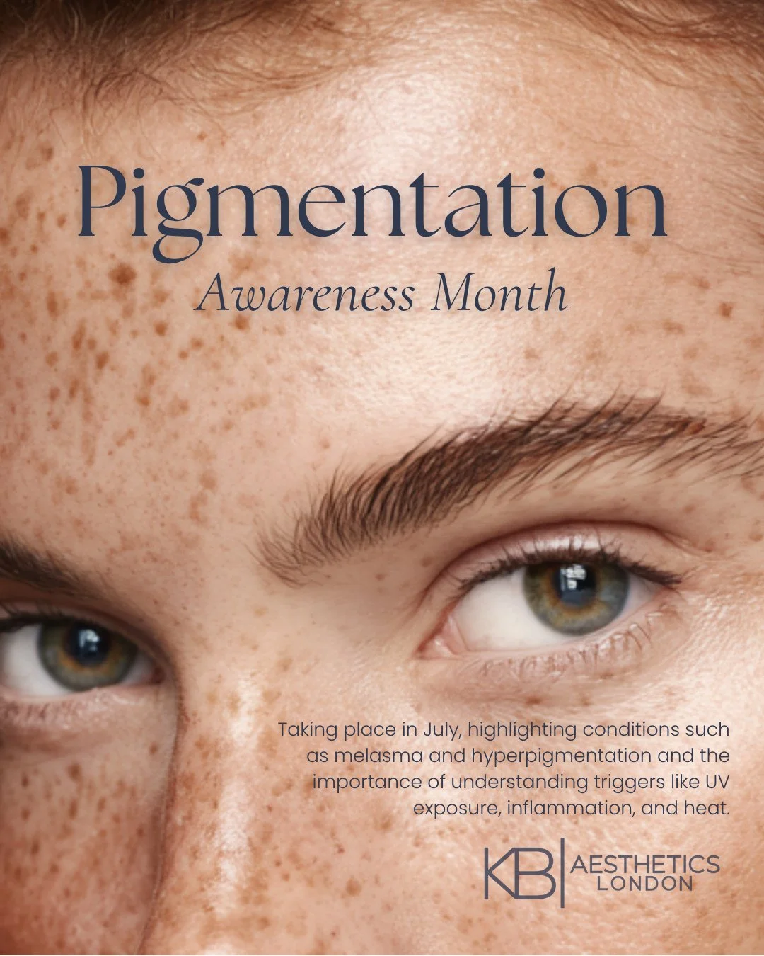 July marks Pigmentation Awareness Month, and this carousel highlights some myth vs fiction around uneven tone, dark patches, and conditions like Melasma. ☀️✨⁠
⁠
Swipe through to separate myth from fact, understand what actually drives pigmentation, a