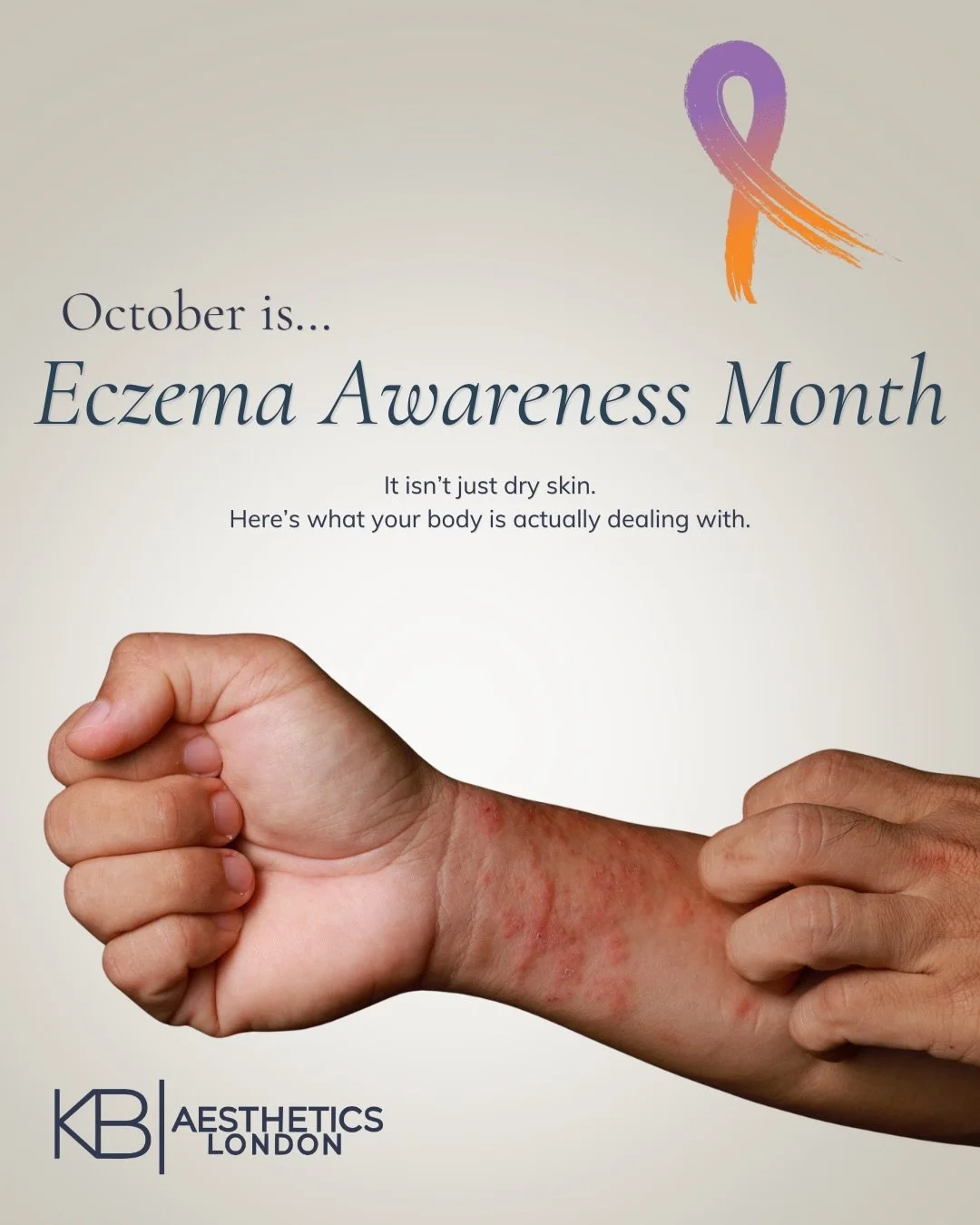 October is all about eczema awareness at KB Aesthetics. 🤍

Throughout the next month, we&rsquo;ll be focusing on eczema, the skin barrier, common triggers and ways to better support sensitive, reactive skin.

Follow along as we break down the facts 