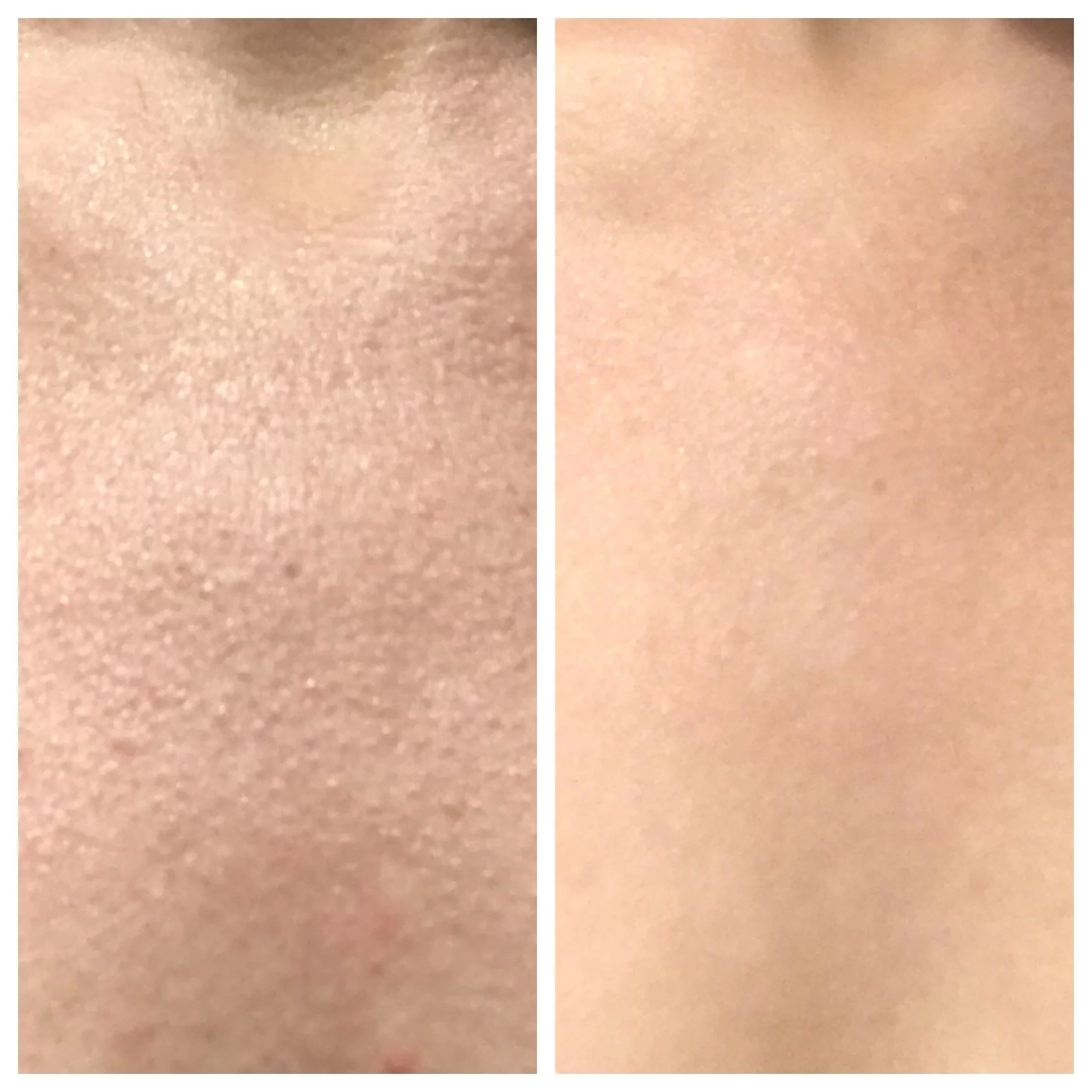 B and A wow fusion toxin chest.JPG