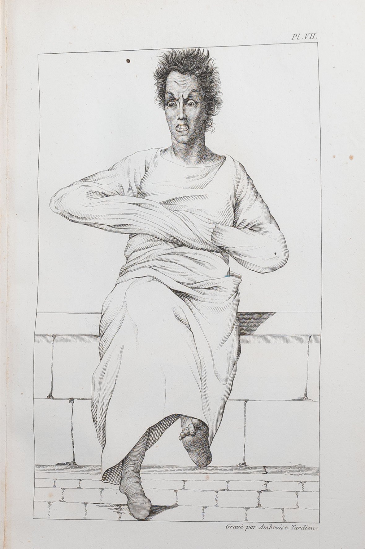 1838 - "Faces of Madness": Esquirol's Landmark Psychiatric Atlas, with 27 Haunting Engraved Portraits