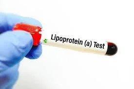 Lp(a) | Lipoprotein (a) | Serum