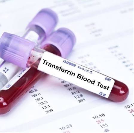 Transferrin | Serum