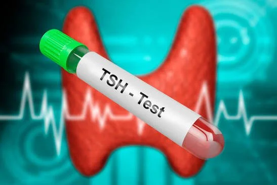 TSH | Thyroid Stimulating Hormone