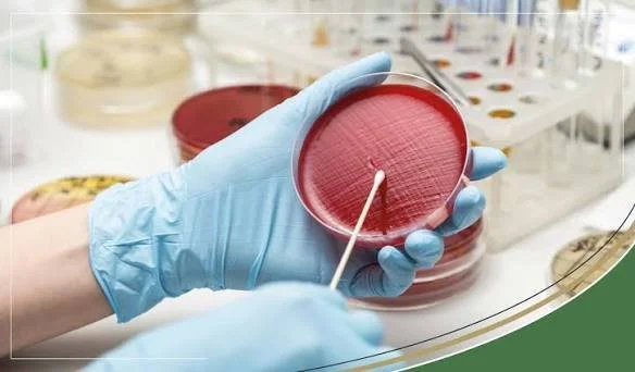 Urinalysis | with Reflex to Culture