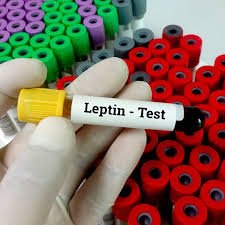 Leptin | Serum