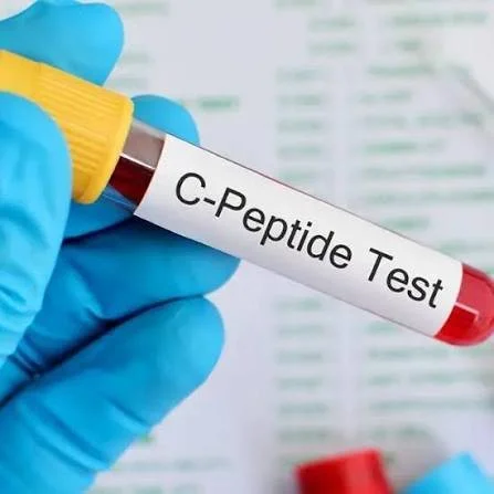 C-Peptide | Serum