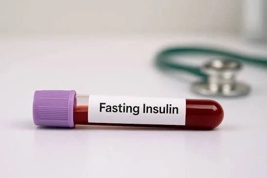 Fasting Insulin | Serum