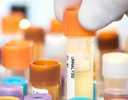 Urinalysis | Complete