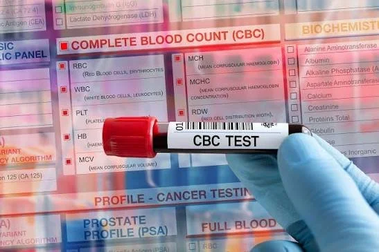 CBC | Complete Blood Count w/Diff | Whole Blood