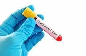 GGT | Gamma-Glutamyl Transferase