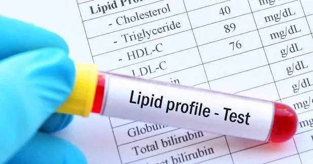 Lipid Panel | Serum