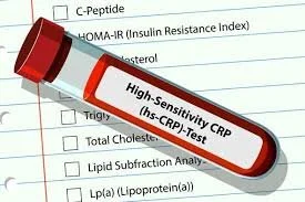 hs-CRP | Serum