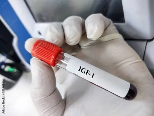 IGF-1 | Serum