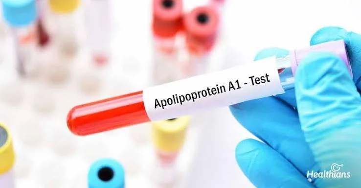 ApoA1 | Apolipoprotein A12 | Serum