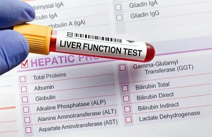Hepatic Function Panel | Serum