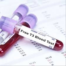 Free T3 | Serum