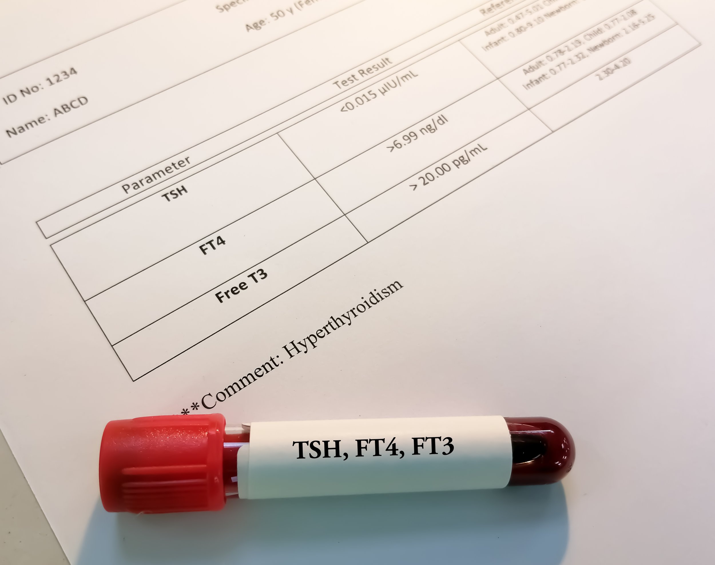 Thyroid Panel with TSH | Serum