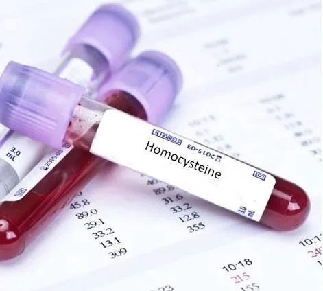 Homocysteine | Serum
