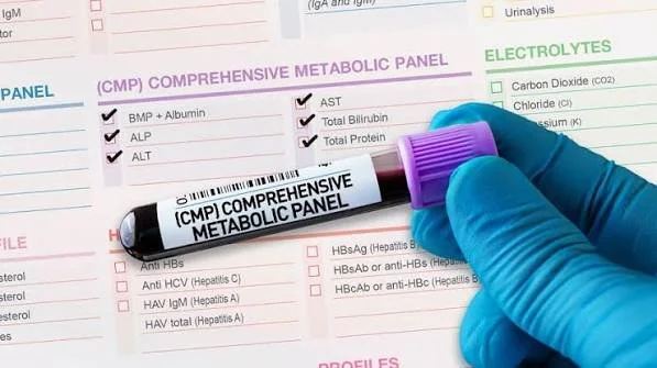 CMP | Comprehensive Metabolic Panel | Serum