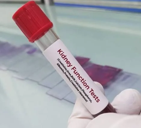 Kidney Profile | Serum