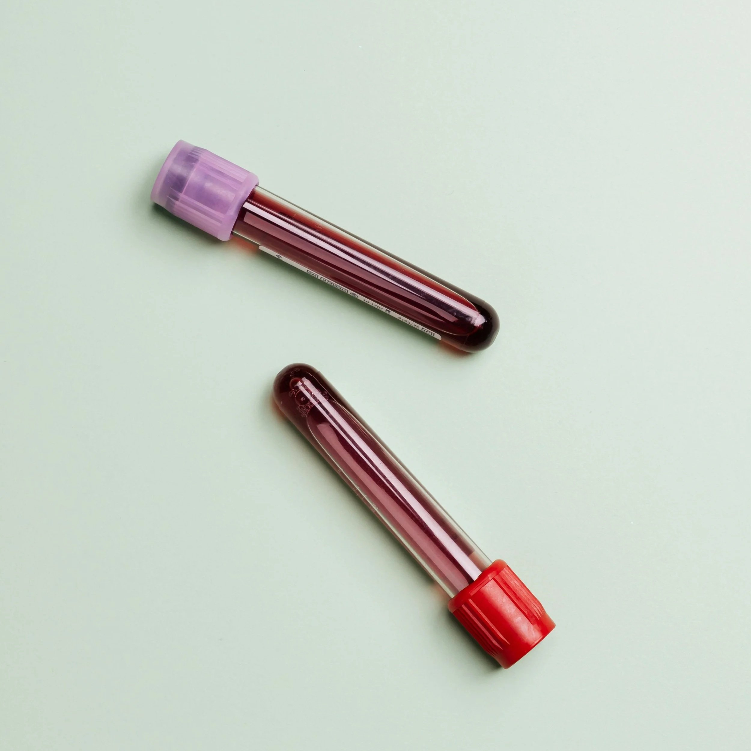 Ferritin and Hair Loss