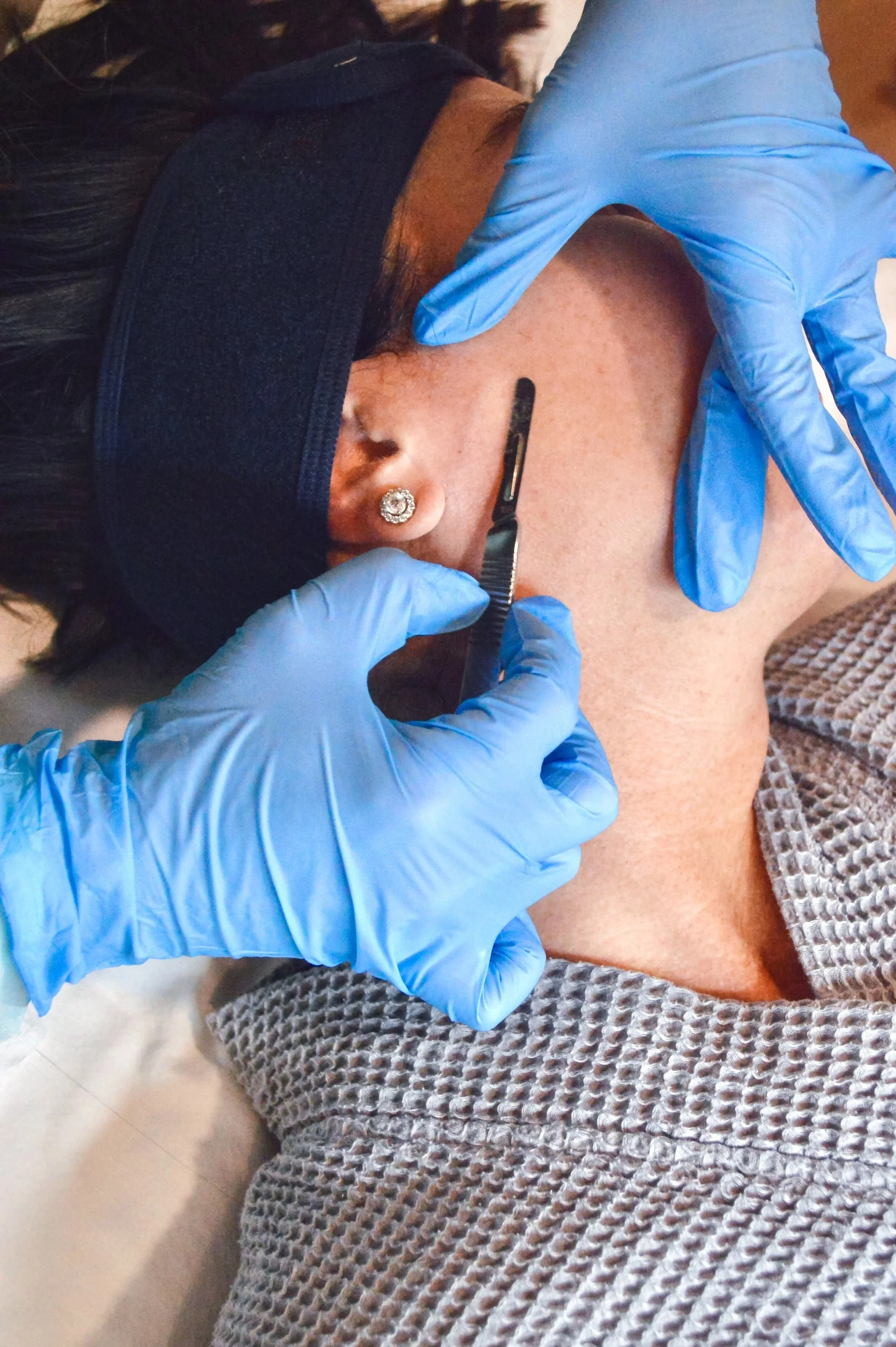 Dermaplane Facial in Birmingham, Alabama