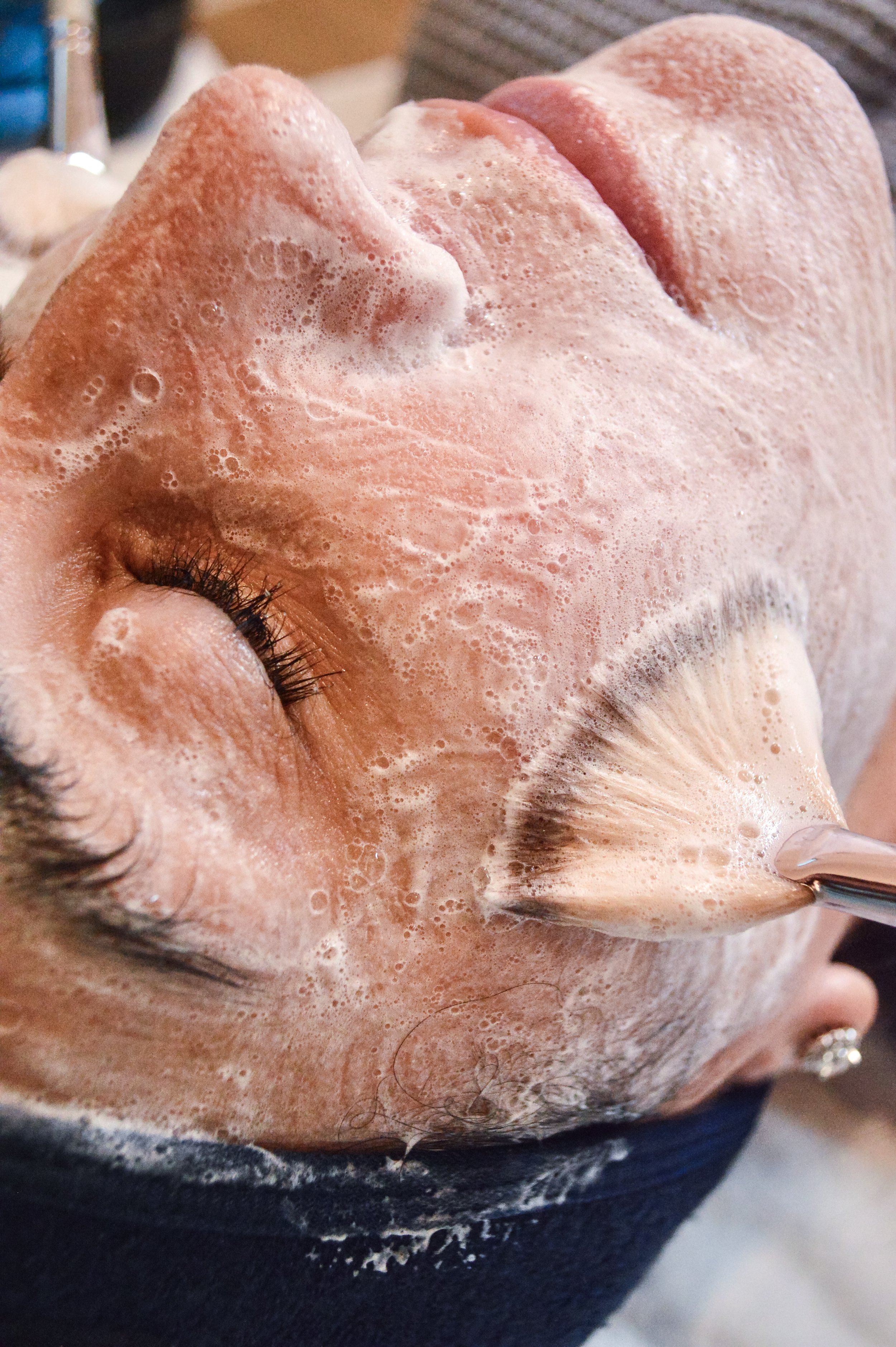 Skincare Treatments in Birmingham, Alabama