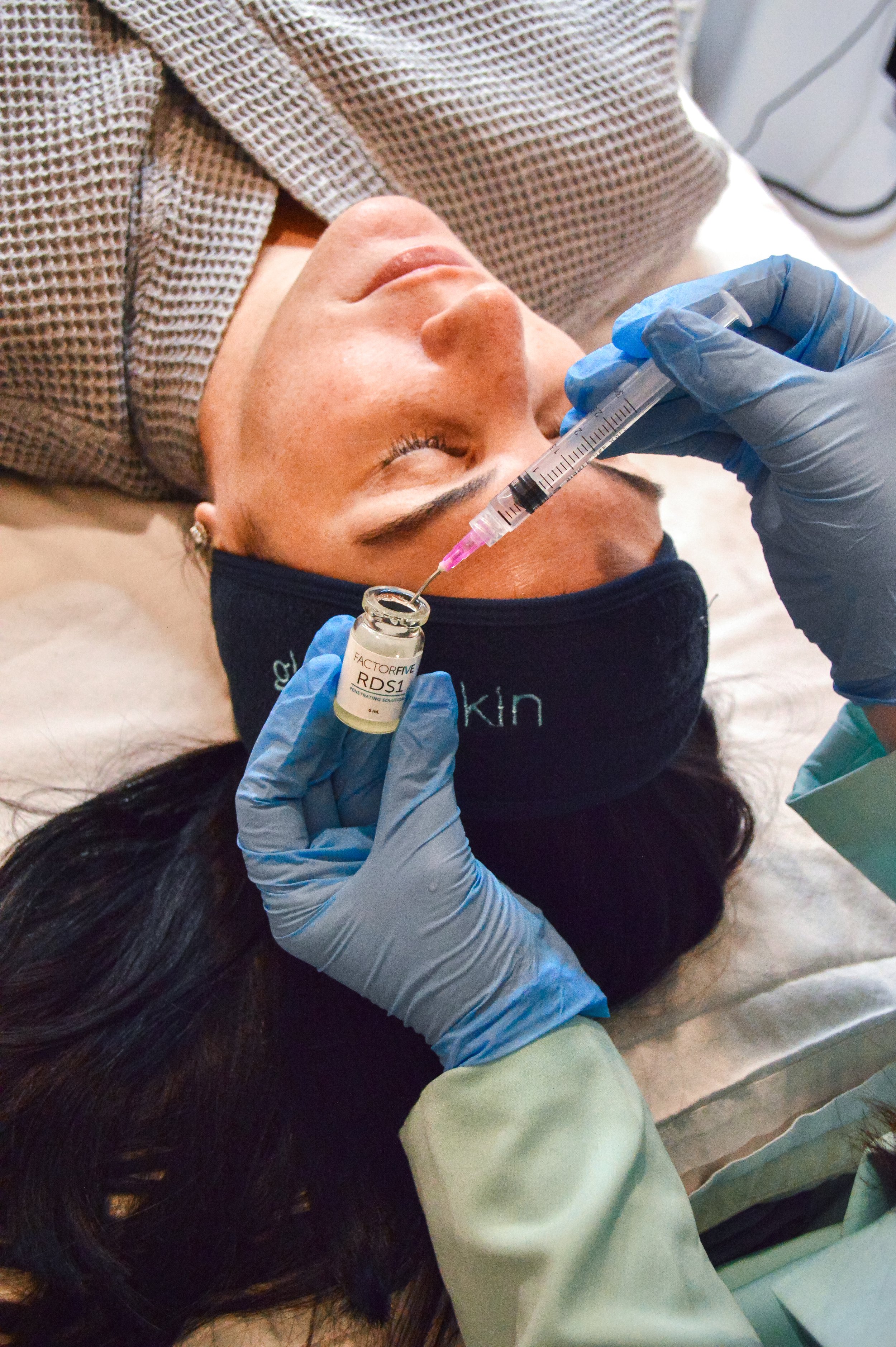 Chemical Peel in Birmingham, Alabama