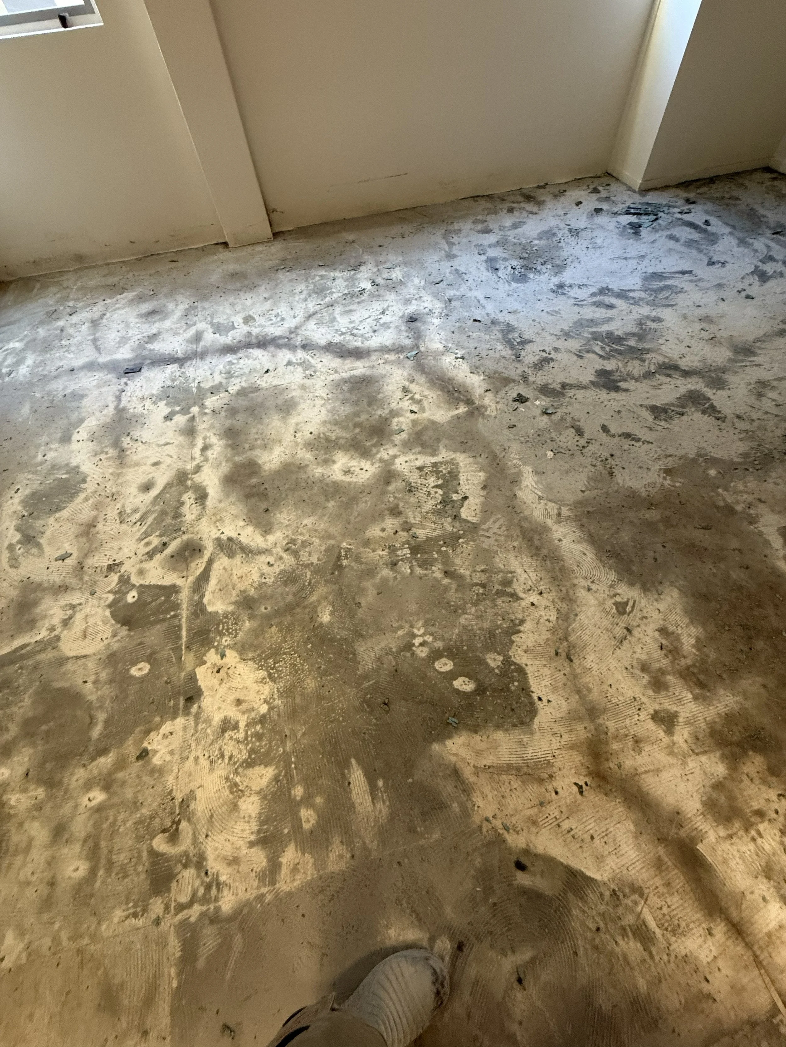 After Removal