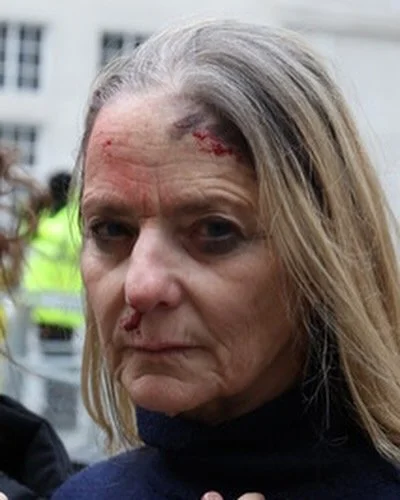 Outside the BBC HQ while time is running out for the Israeli hostages and the lack of outrage and silence of the media is deafening.  #bringthemhomenow #timeisrummingout makeup by @moranrazzakai #october7 #metoounlessurajew #rapeisnotresistance