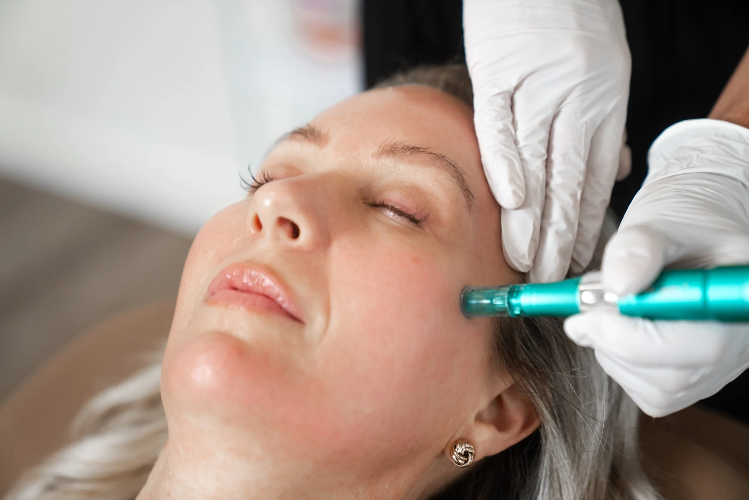 Glo + Go (Lunchtime Peel)