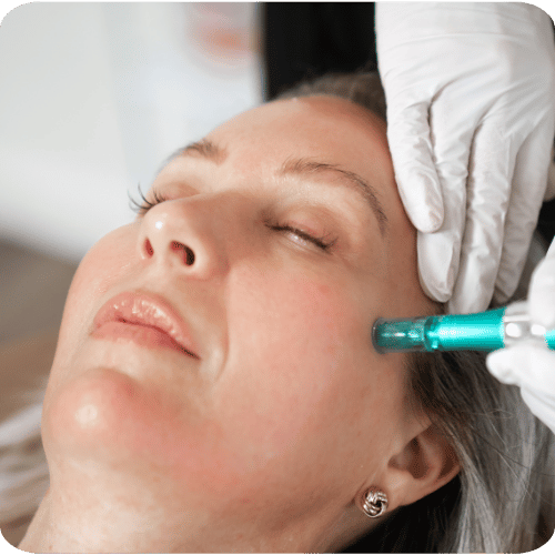 Glo + Go Peel