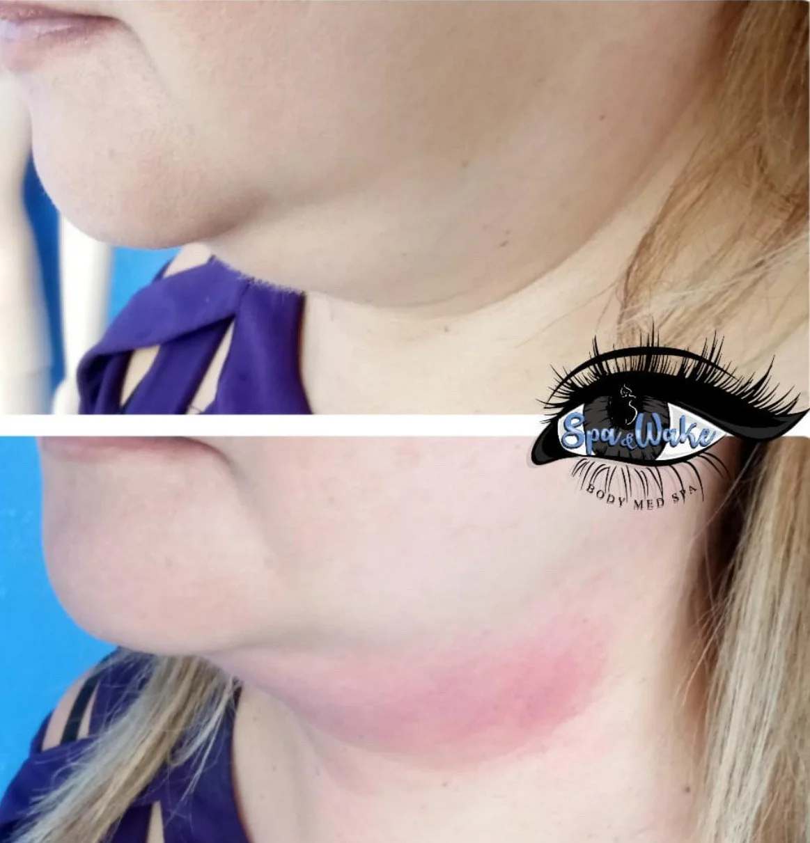 image_123650291 (3).JPG