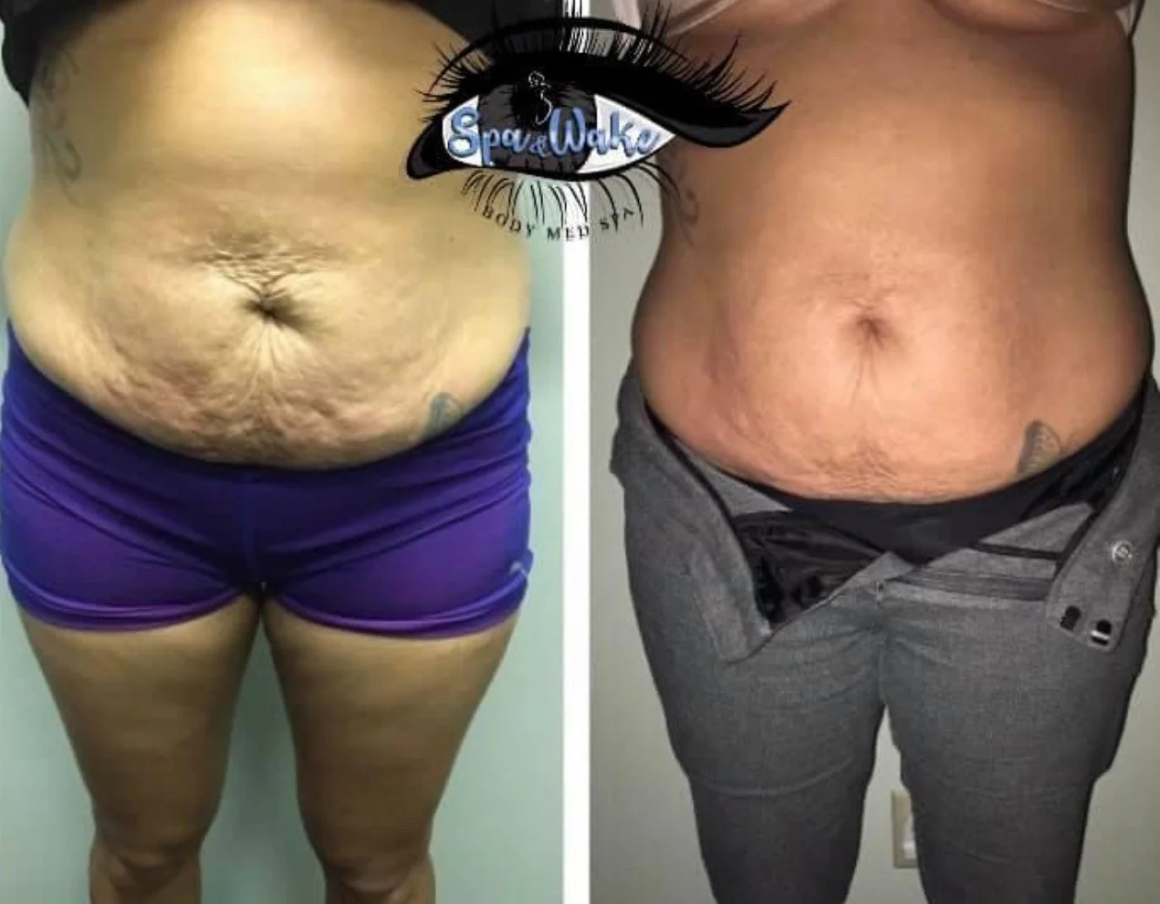 image_123650291 (6).JPG