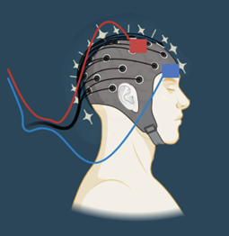 A human head illustrating a brain scan with electrodes connected to a headgear for research into aphasia