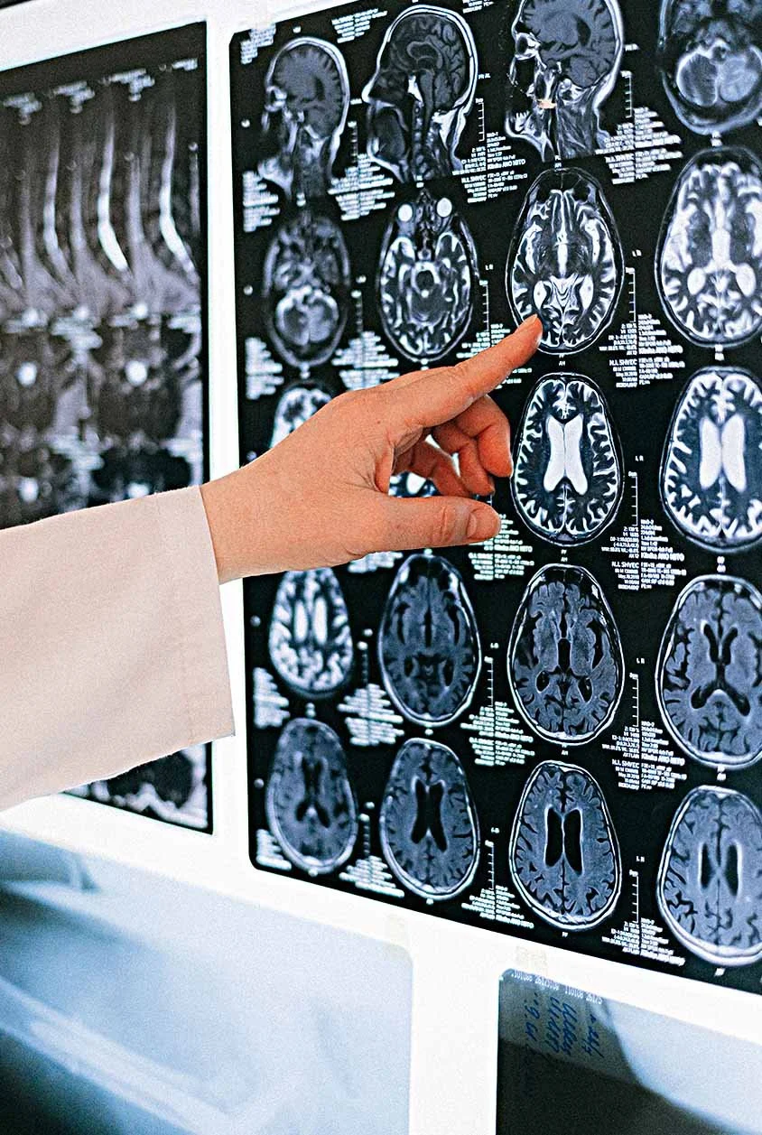 doctor reviewing brain scans