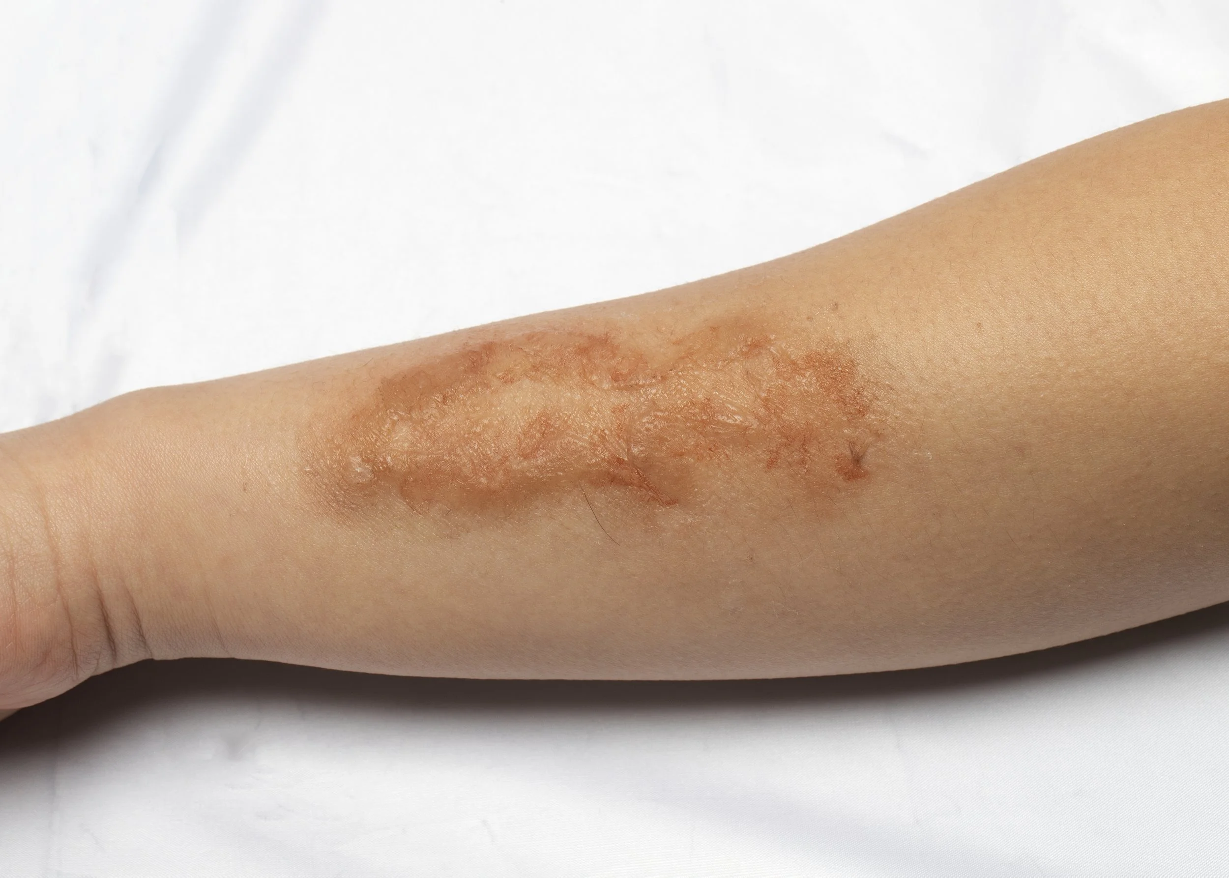 The Impact FX Collection ~Aged Heat Trauma