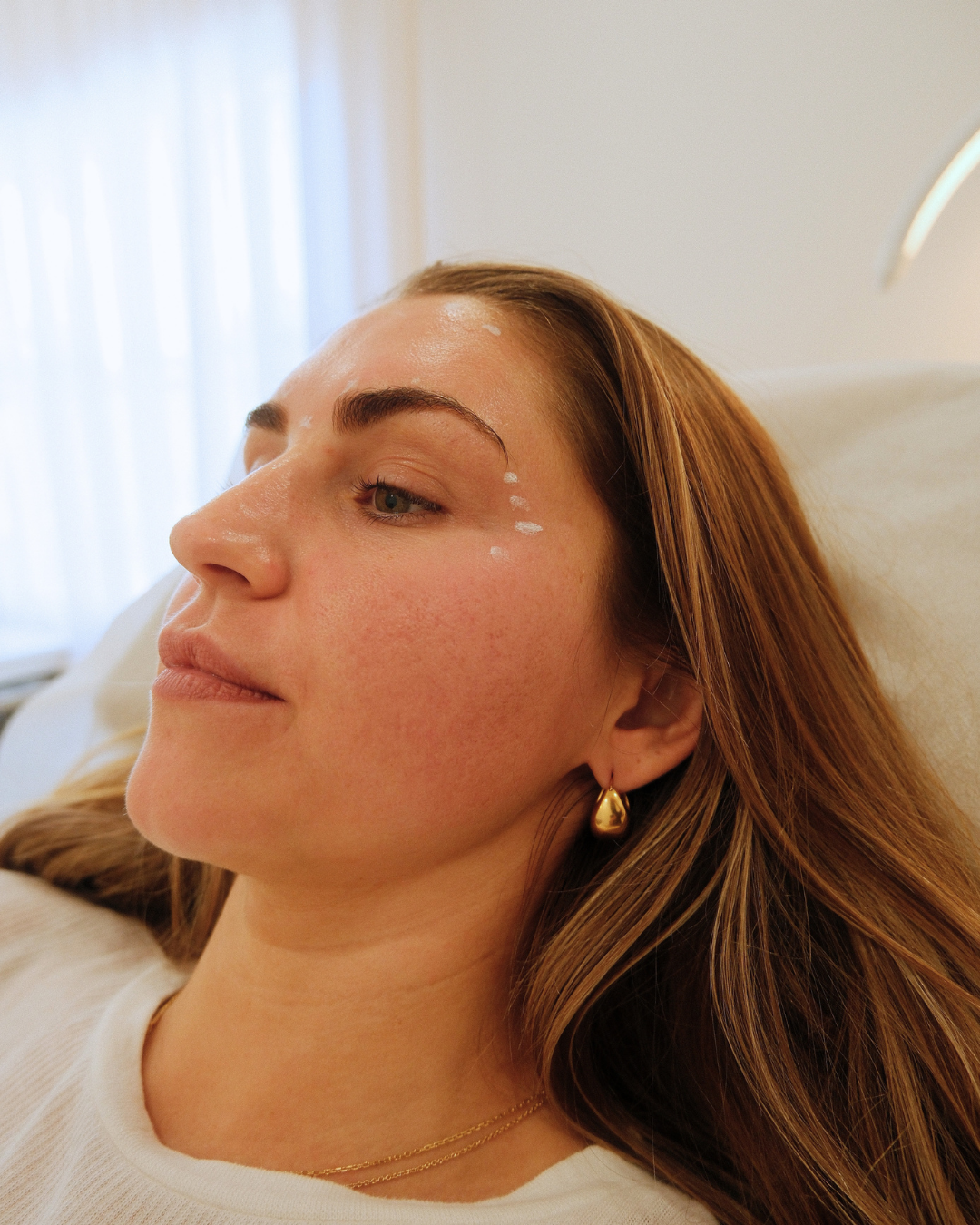 5 Signs Your Skin is Ready for Its First Professional Treatment