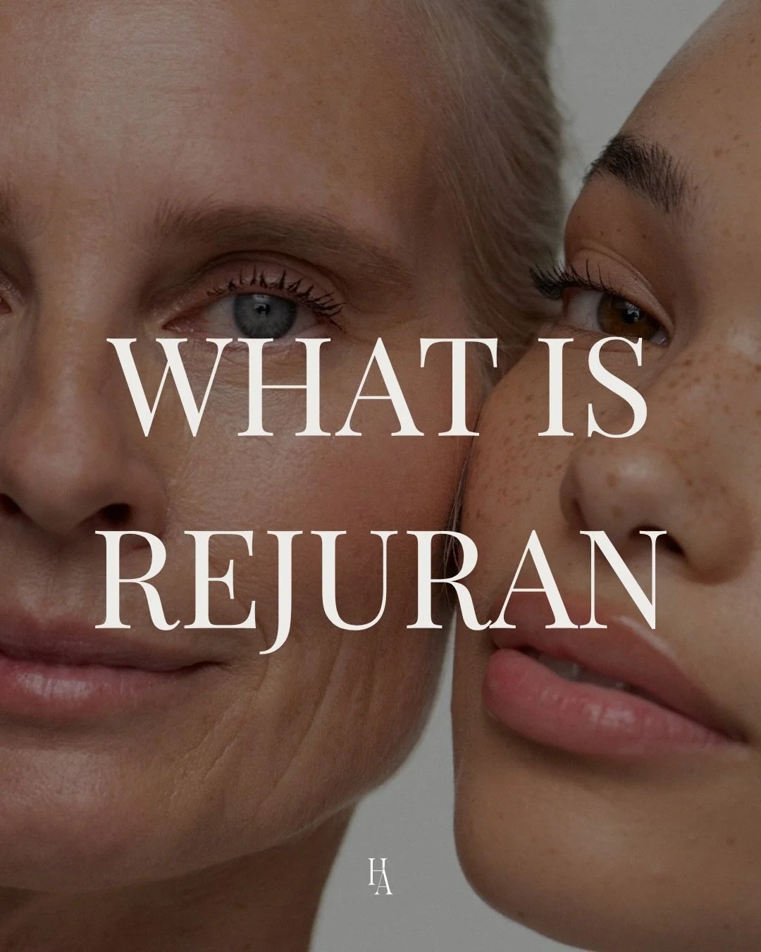 What is Rejuran? 

If you&rsquo;ve been seeing this treatment everywhere, here&rsquo;s what you need to know. Rejuran is a skin-healing injectable made from DNA-based molecules derived from salmon. When introduced into the skin, they repair damaged c