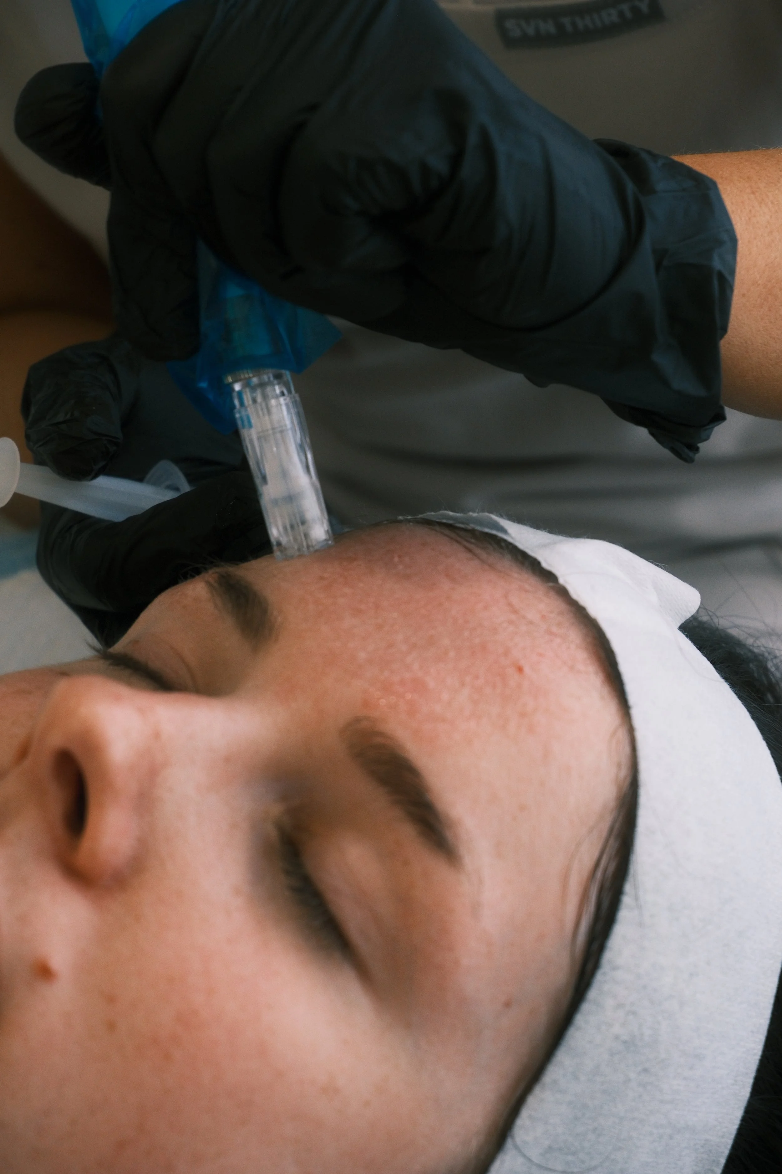 WHAT ARE EXOSOMES?