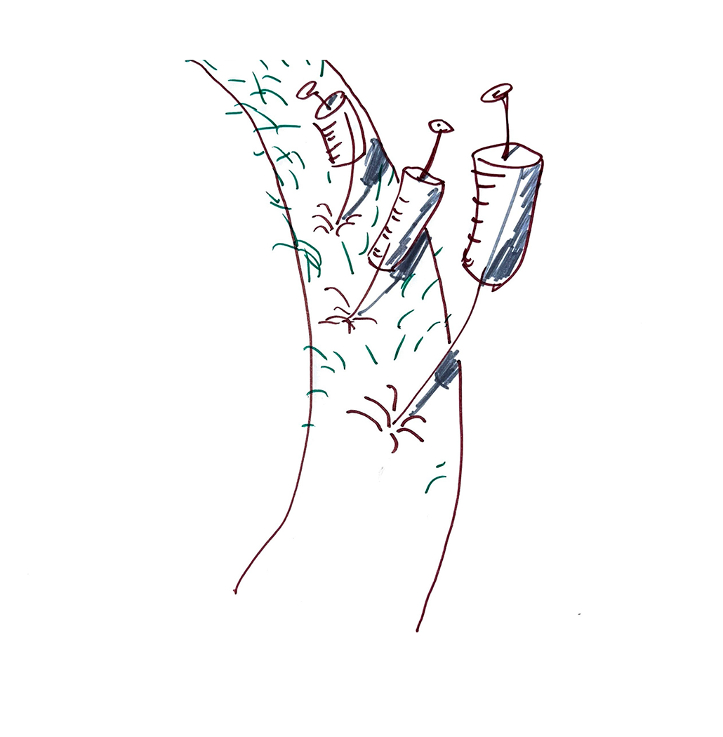 ER.png