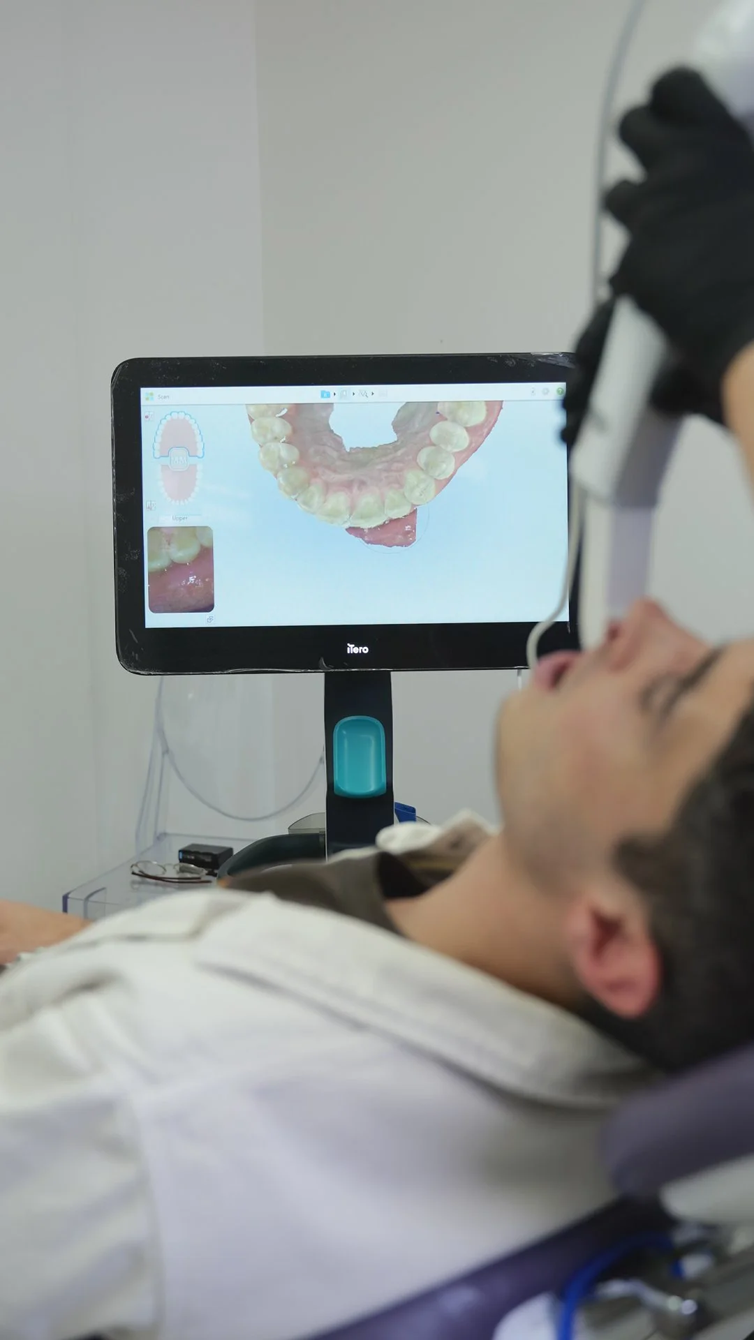 How to Explain Complex Dental Technology on Video Without Overwhelming Buyers