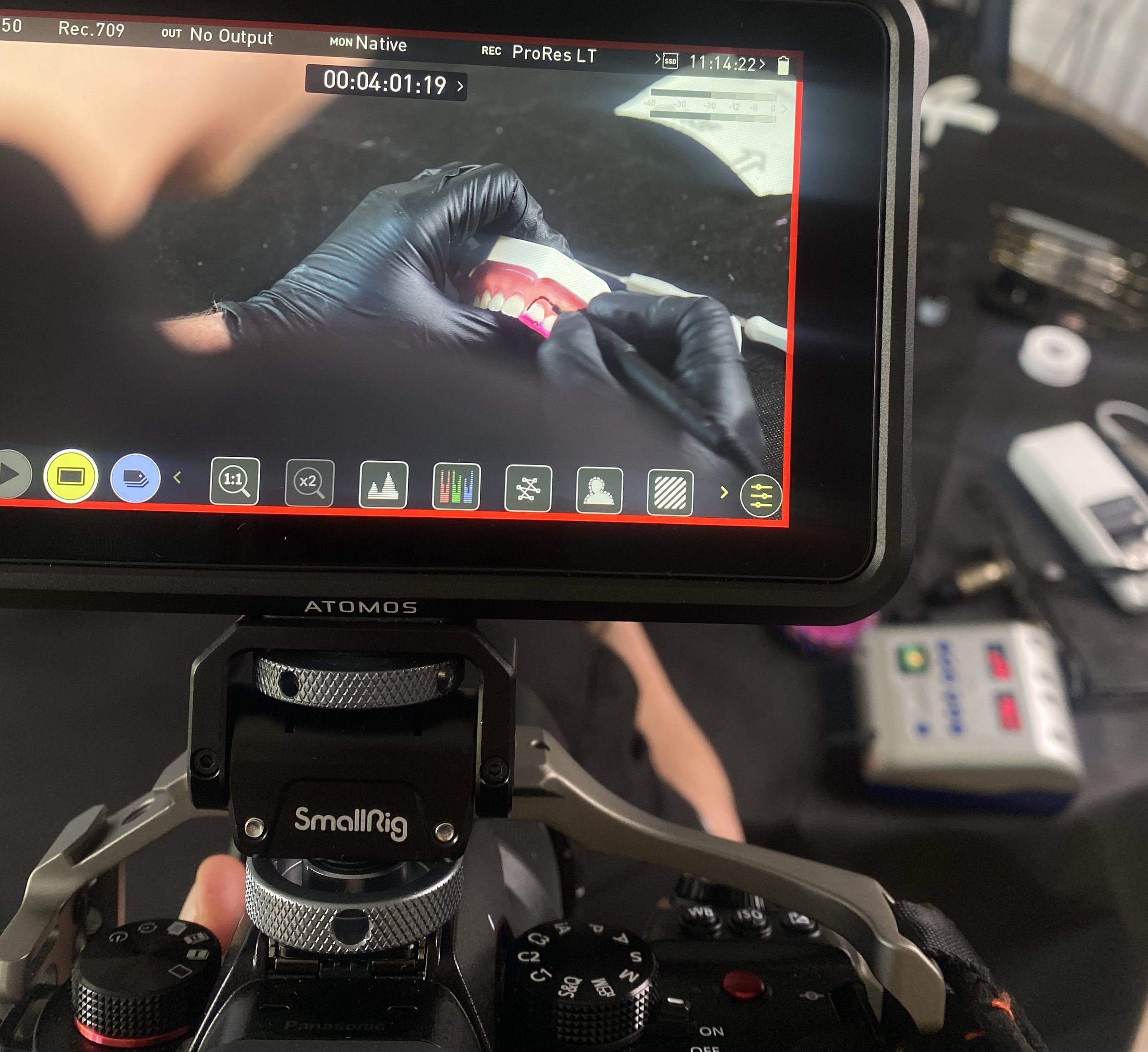 From Veneers to Full Smile Makeovers: How to Capture Cosmetic Dentistry Transformations on Video