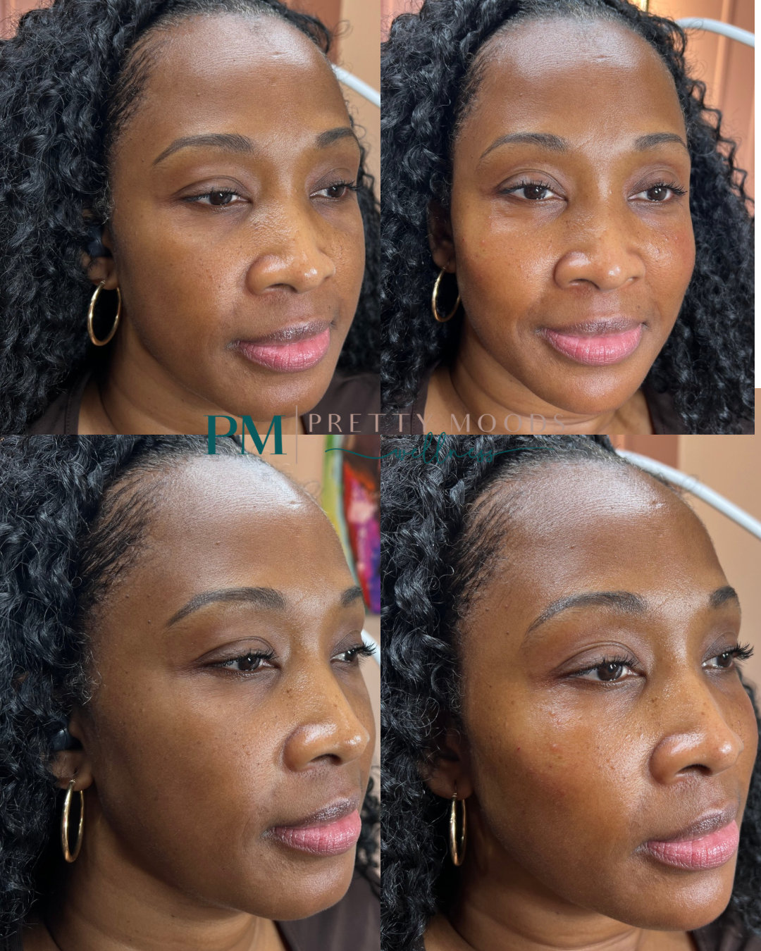 Full Face Balance -Top Tier Medspa in Altamonte Springs, FL 32714