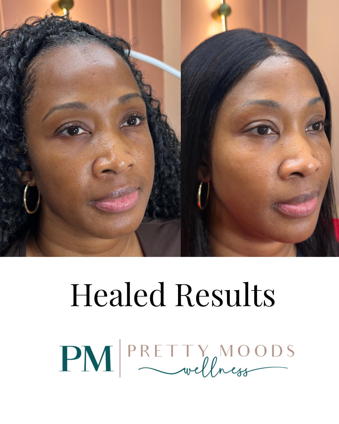 Full Face Balance -Top Tier Medspa in Altamonte Springs, FL 32714