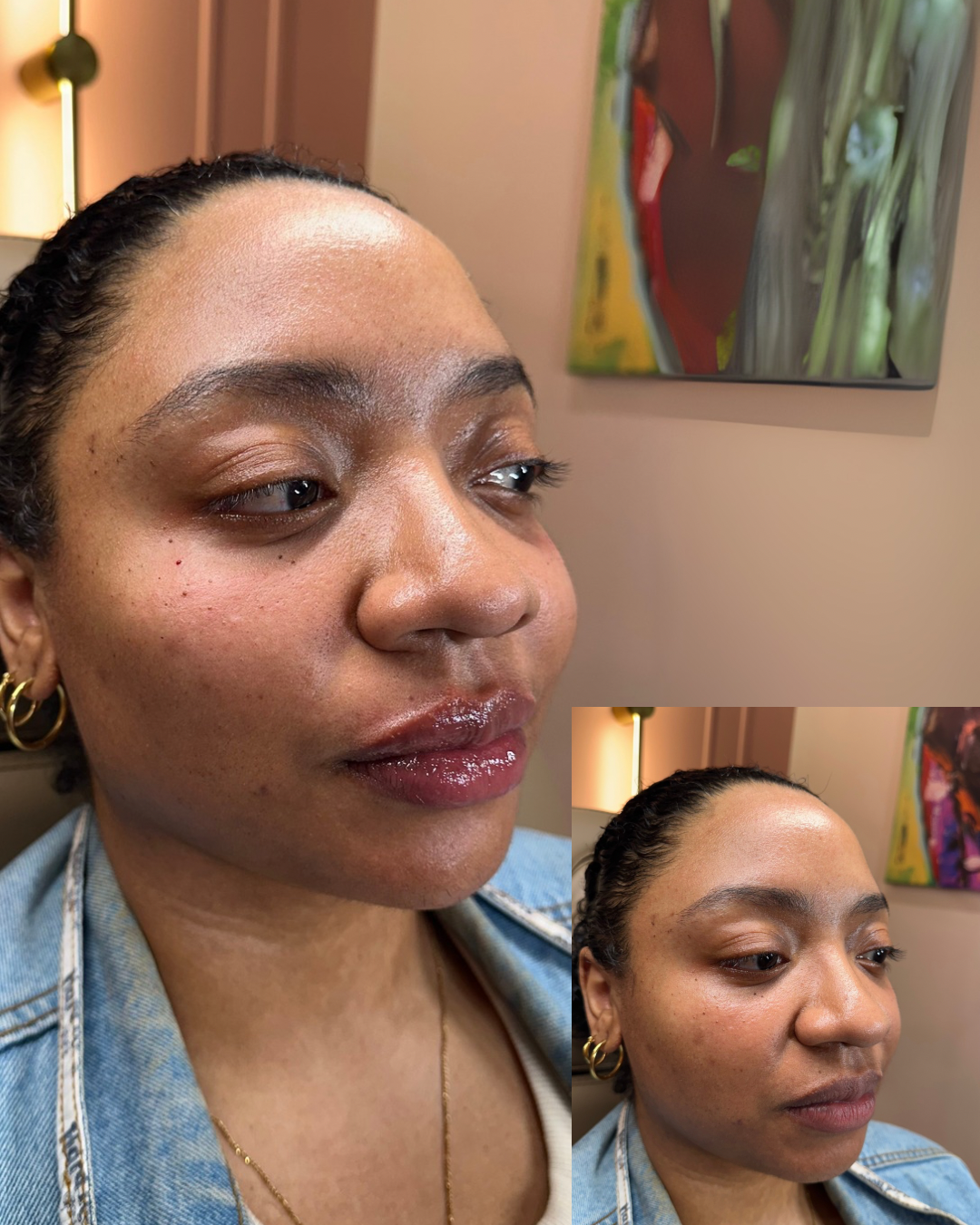 Full Face Balance -Top Tier Medspa in Altamonte Springs, FL 32714