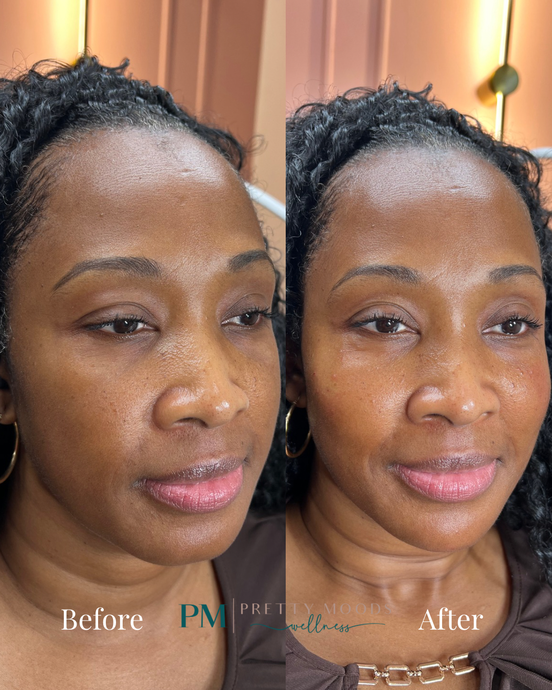 Full Face Balance -Top Tier Medspa in Altamonte Springs, FL 32714