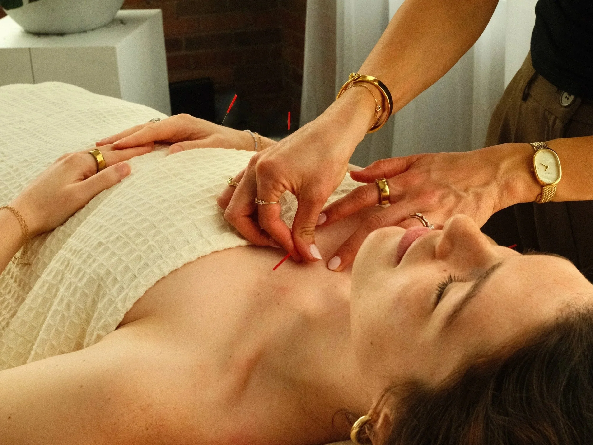 woman performing acupuncture on comfy bed with plant in background